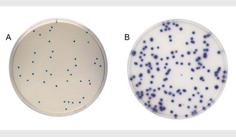 Fig. 2 A) Colonies d’entérocoques typiques avec une coloration verte sur gélose Compass 
Enterococcus. B) Chromogenic Coliform Agar avec des colonies typiques d’Escherichia coli en bleu.