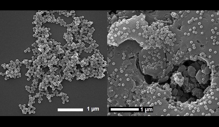 Avec l’utilisation tout azimut de matériaux plastiques depuis les années 1950, de nouveaux polluants, comme les micro- et nanoplastiques, ont fait leur apparition. L'étude présentée ici a évalué la capacité d’adsorption et d’élimination de nanoplastiques par adsorption sur charbon actif utilisé dans les filières de potabilisation.