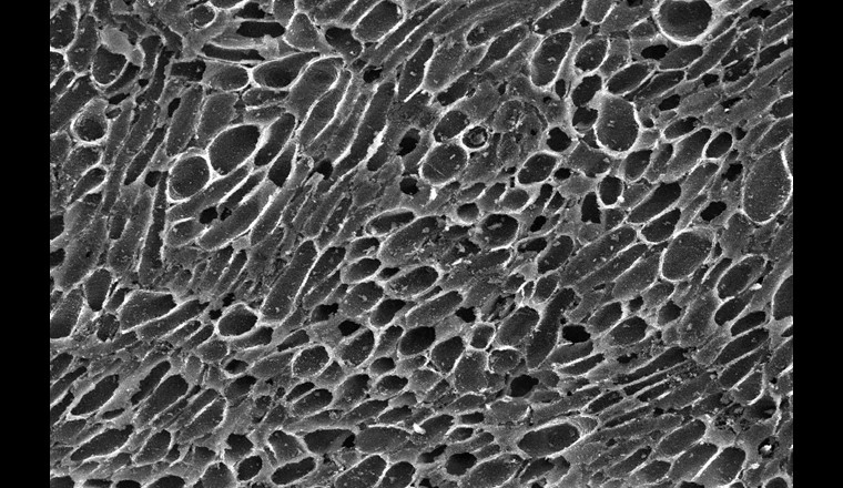 Les métabolites du chlorothalonil sont des composés polaires  peu éliminables par des procédés de traitement conventionnel. L'adsorption sur charbon actif est toutefois une solution envisageable, surtout après optimisation du processus. Sur la photo: charbon actif prise au microscope électronique à balayage (© Tony Merle)