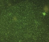 Sind nur grosse Wasserbakterien antibiotikaresistent? Durchflusszytometrie verknüpft mit Molekularbiologie gibt Aufschluss. (©AdobeStock) Sind nur grosse Wasserbakterien antibiotikaresistent? Durchflusszytometrie verknüpft mit Molekularbiologie gibt Aufschluss. (©AdobeStock)