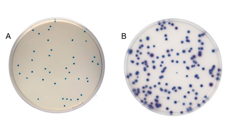 Fig. 2 A) Colonies d’entérocoques typiques avec une coloration verte sur gélose Compass 
Enterococcus. B) Chromogenic Coliform Agar avec des colonies typiques d’Escherichia coli en bleu.