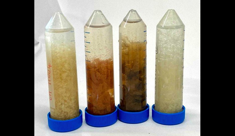 I biofilm provenienti da diversi tubi doccia differiscono per colore e consistenza, oltre che per le comunità microbiche, che sono state esaminate con l'analisi molecolare (Foto: Eawag, Frederik Hammes).