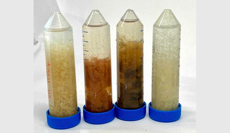 Les biofilms de différents tuyaux de douche se distinguent par leur couleur et leur consistance, tout comme par leurs communautés microbiennes, qui ont fait l’objet d’analyses moléculaires (Photo: Eawag: Frederik Hammes).