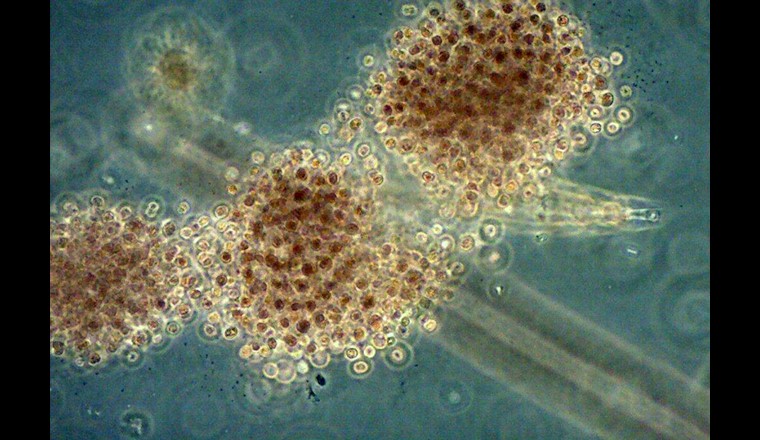 Una specie di cianobatteri: Microcystis