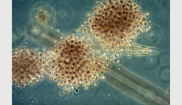 Una specie di cianobatteri: Microcystis