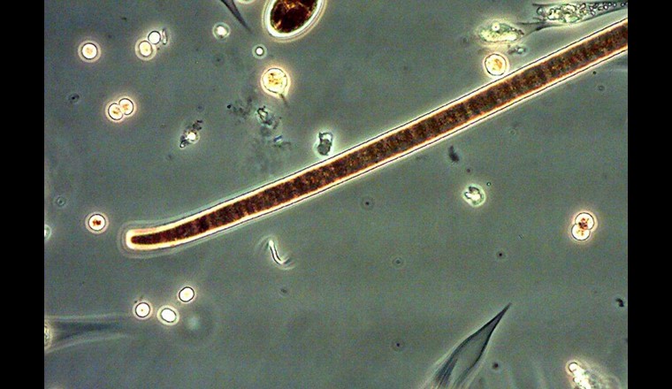 Una specie di cianobatteri: Planktothrix