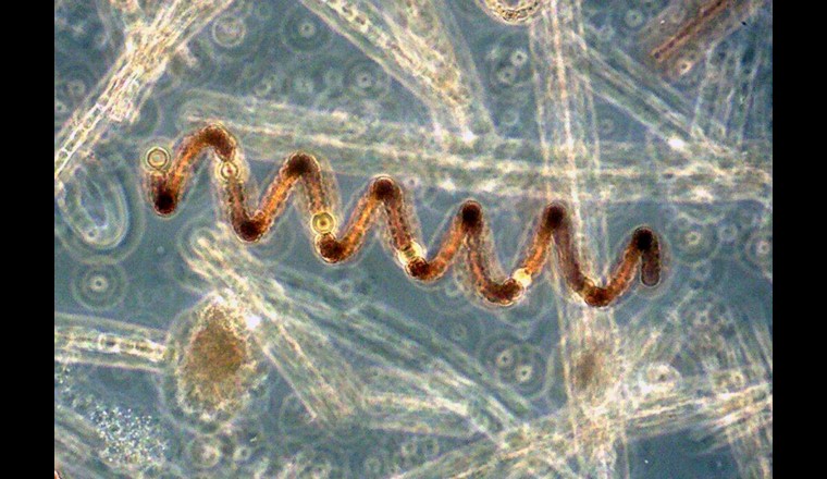 Una specie di cianobatteri: Anabeana