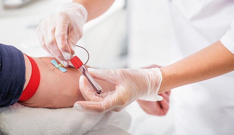 Fig. 1 Die Langzeitstudie «Human Biomonitoring» zu den Auswirkungen von PFAS auf die Gesundheit der Bevölkerung wird aus Spargründen gestoppt. (© Adobe Stock)