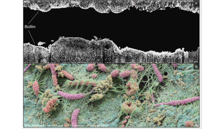 Fig. 2 Heterogenität innerhalb von 4 mm eines Duschschlauch-Biofilms. Optische Kohärenztomografie wurde zur Visualisierung und Quantifizierung der räumlichen Heterogenität genutzt (A), Rasterelektronenmikroskopie zur Betrachtung von Bestandteilen und der Zusammensetzung der Biofilmmatrix in höherer Auflösung (B).