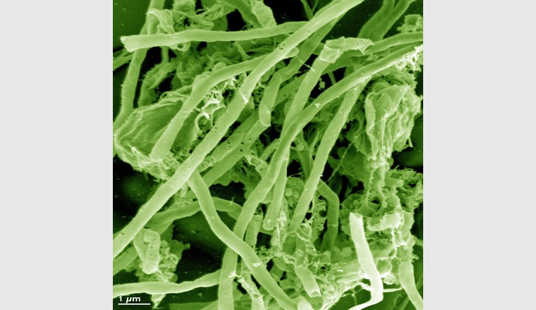 Methanogene Archaeen dienen als Biokatalysator.                         Foto: Electrochaea GmbH   