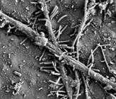 Bakterien gesellen sich für den Bioabbau zu den Pilzfäden.  Foto: ETH Zürich Bakterien gesellen sich für den Bioabbau zu den Pilzfäden.  Foto: ETH Zürich