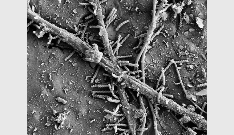 Bakterien gesellen sich für den Bioabbau zu den Pilzfäden.  Foto: ETH Zürich