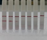 Um im Fall fäkaler Verunreinigungen in Gewässern das Problem rasch lösen zu können, muss man möglichst schnell die Ursache feststellen. Abhilfe schafft ein einfacher Streifentest. Dieser gibt mithilfe simpler DNA-Tests direkt vor Ort Auskunft über die Verunreinigungen. (© TU Wien) Um im Fall fäkaler Verunreinigungen in Gewässern das Problem rasch lösen zu können, muss man möglichst schnell die Ursache feststellen. Abhilfe schafft ein einfacher Streifentest. Dieser gibt mithilfe simpler DNA-Tests direkt vor Ort Auskunft über die Verunreinigungen. (© TU Wien)