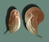 Wasserflöhe schützen sich vor Fressfeinden: Typische Körperform des Wasserflohs Daphnia longicephala: links ohne, rechts mit Verteidigungsstrukturen. Die Kopfhaube erinnert an einen Helm und reduziert deutlich das Risiko, gefressen zu werden. Plastikpartikel fangen die Botenstoffe ab, die die Ausbildung der Verteidigungsstrukturen bewirken. Foto: Christian Laforsch. Wasserflöhe schützen sich vor Fressfeinden: Typische Körperform des Wasserflohs Daphnia longicephala: links ohne, rechts mit Verteidigungsstrukturen. Die Kopfhaube erinnert an einen Helm und reduziert deutlich das Risiko, gefressen zu werden. Plastikpartikel fangen die Botenstoffe ab, die die Ausbildung der Verteidigungsstrukturen bewirken. Foto: Christian Laforsch.