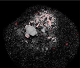 Bild aus dem Fluoreszenzmikroskop: Methanoliparia-Zellen, die an einem Öltröpfchen haften. (Foto: Max-Planck-Institut für Marine Mikrobiologie)