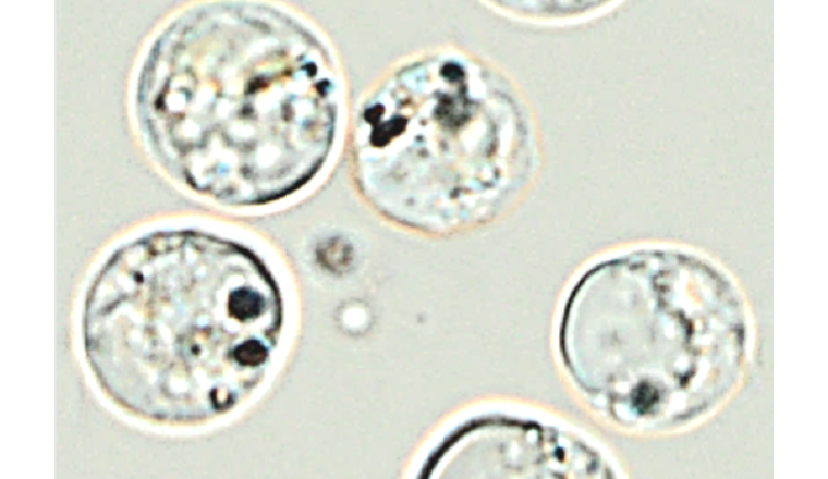 Image de l’absorption de nanoargent par l’algue brune-dorée Poterioochromonas malhamensi, réalisée par microscopie optique.  (© Université de Genève)