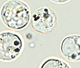 Image de l’absorption de nanoargent par l’algue brune-dorée Poterioochromonas malhamensi, réalisée par microscopie optique.  (© Université de Genève)