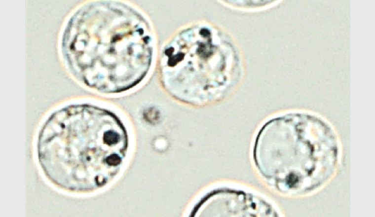 Image de l’absorption de nanoargent par l’algue brune-dorée Poterioochromonas malhamensi, réalisée par microscopie optique.  (© Université de Genève)