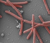 Die Mikrobe des Jahres 2021, Methanothermobacter, 30'000fach vergrössert. (©A. Klingl, München)