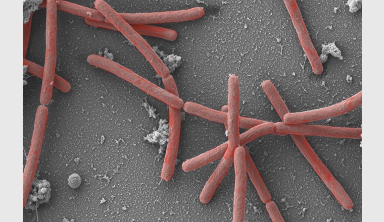 Die Mikrobe des Jahres 2021, Methanothermobacter, 30'000fach vergrössert. (©A. Klingl, München)