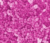 Partikel im Nanometer-Bereich (Elektronenmikroskopische Aufnahme, nachkoloriert, 50 000-fache Vergrösserung) (Bild: Empa / ETH) Partikel im Nanometer-Bereich (Elektronenmikroskopische Aufnahme, nachkoloriert, 50 000-fache Vergrösserung) (Bild: Empa / ETH)