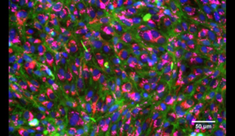 Angefärbte, gesunde Kiemenzellen von Regenbogenforellen: Zellkerne (blau), Membranen (grün), Mitochondrien (rot), Lysosome (pink). Foto: Vivian Lu Tan, Eawag