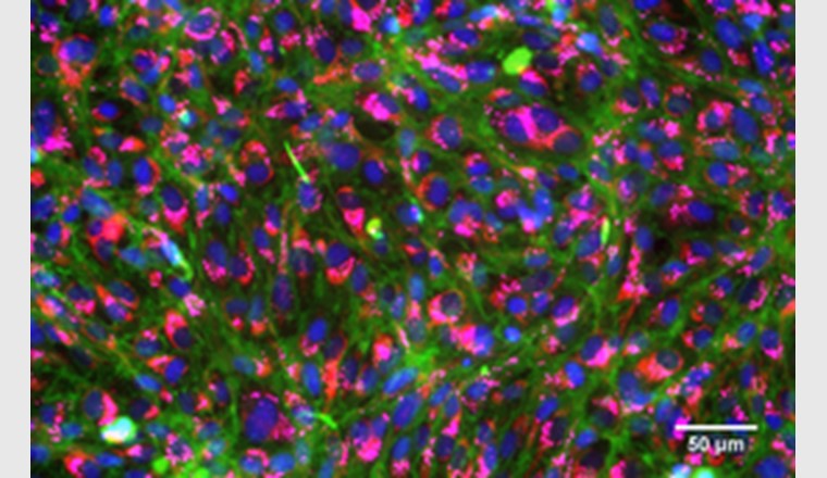 Angefärbte, gesunde Kiemenzellen von Regenbogenforellen: Zellkerne (blau), Membranen (grün), Mitochondrien (rot), Lysosome (pink). Foto: Vivian Lu Tan, Eawag